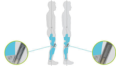 Graphic illustration of a patient with custom-made orthosis knee-ankle-foot KAFO with a NEURO VARIO-SWING system knee joint orthotic joint in stance. Due to the yielding of the dynamic spring unit, a slight hyperextension of the knee is possible. This ensures a high level of stability and additional range of motion.