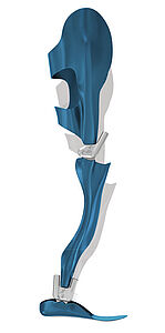 Graphic custom-made orthosis knee-ankle-foot KAFO medical device with a NEURO VARIO-SWING system knee joint orthotic joint and a NEURO SWING system ankle joint. The infinitely adjustable stops allow the knee flexion angle to be adjusted to the tibial inclination. Knee extension is possible due to the yielding of the dynamic spring unit, and the patient has more stability in stance.